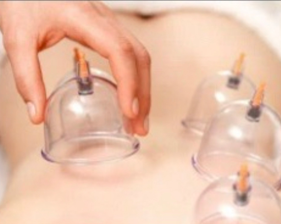 Cupping detail